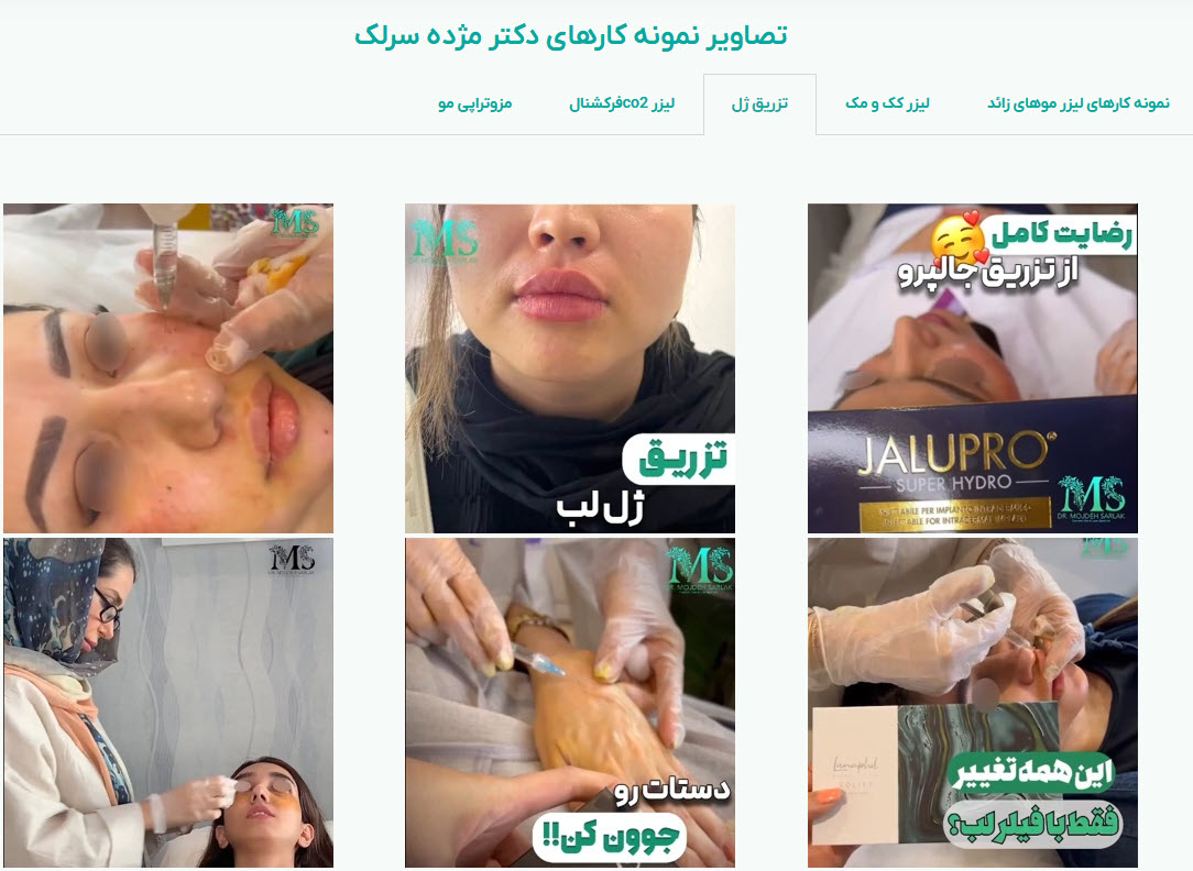 نمونه کارهای دکتر مژده سرلک؛متخصص پوست،مو و زیبایی